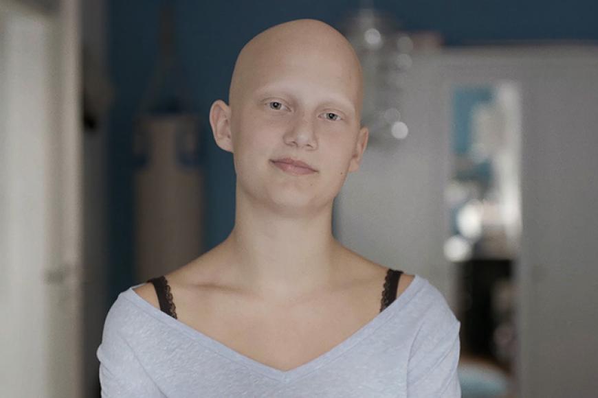 Porträt einer jungen Person ohne Haare